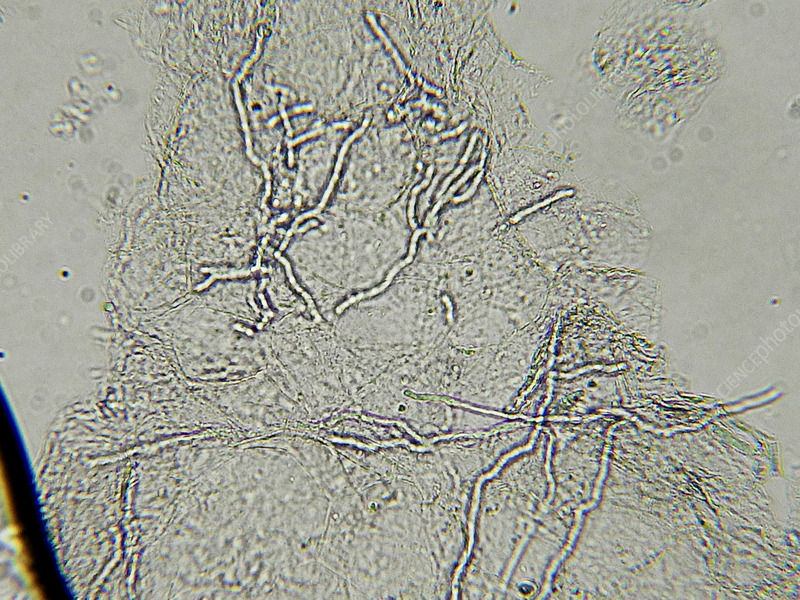KOH Smear